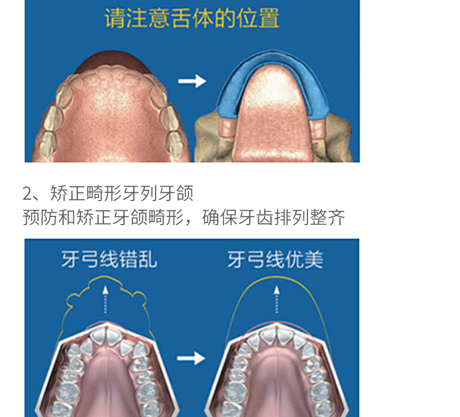 mrc 少年矫正器10