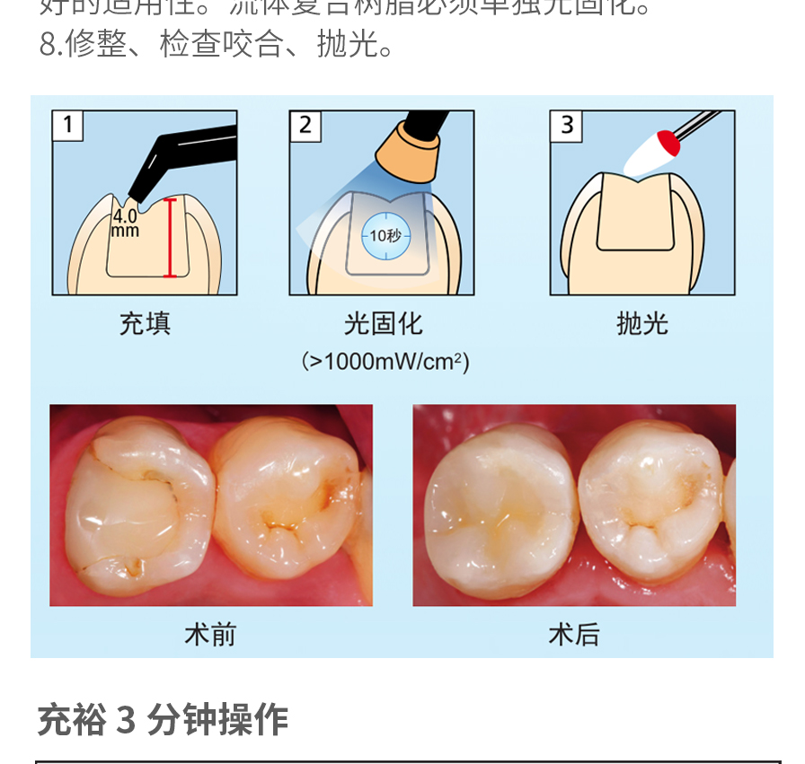 美塑树脂使用步骤图片